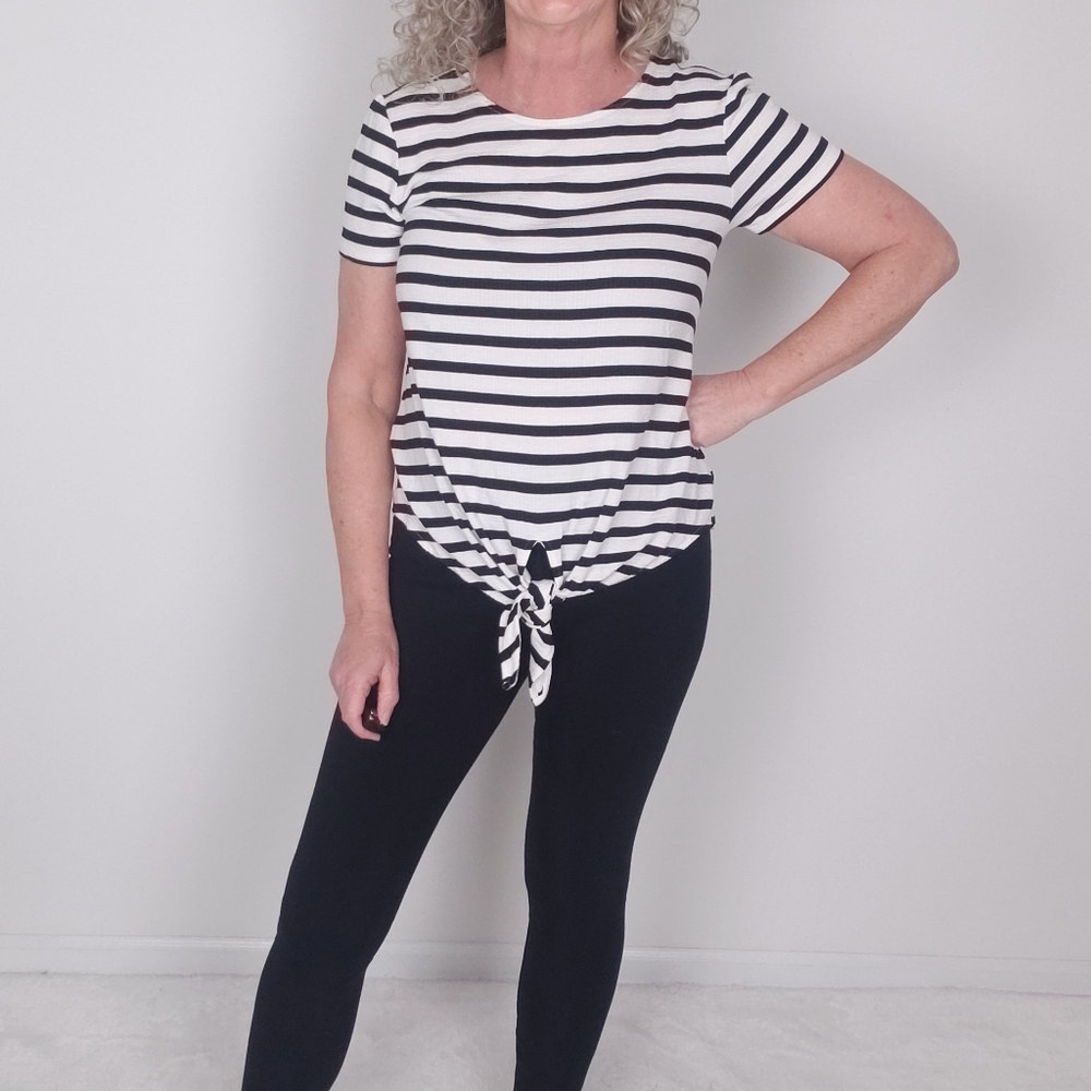 MARLED STRIPE TOP Button Detail - Picture 3 of 7